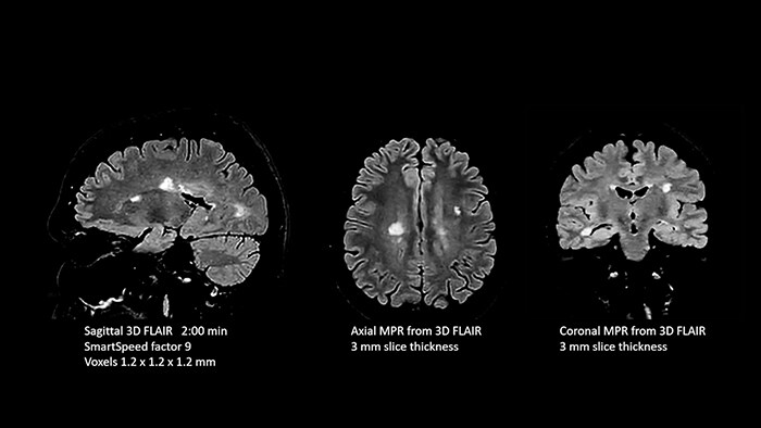 Brain image one