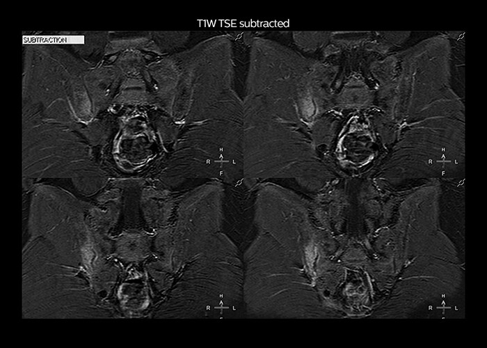 clinical cases tab2 image