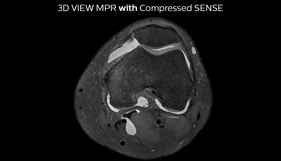 PD mDIXON water knee WITHOUT Compressed SENSE tra