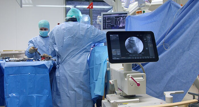 selecting the orthopedic c arm philips healthcare orthopedic technologist
