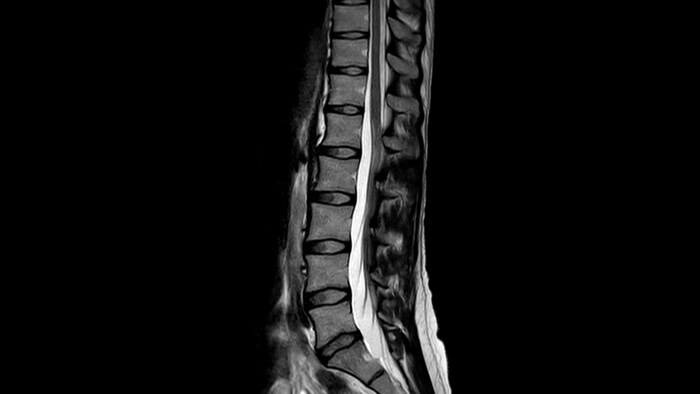 Brain clinical image