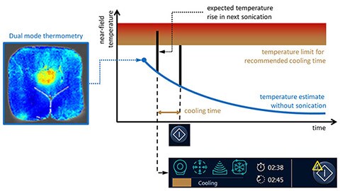 hifu dual mode thermometry L