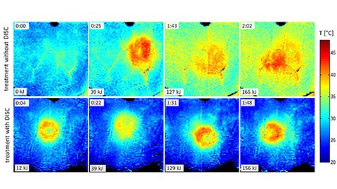 hifu near field temperature evolution LM