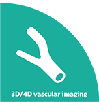 3D vascular imaging