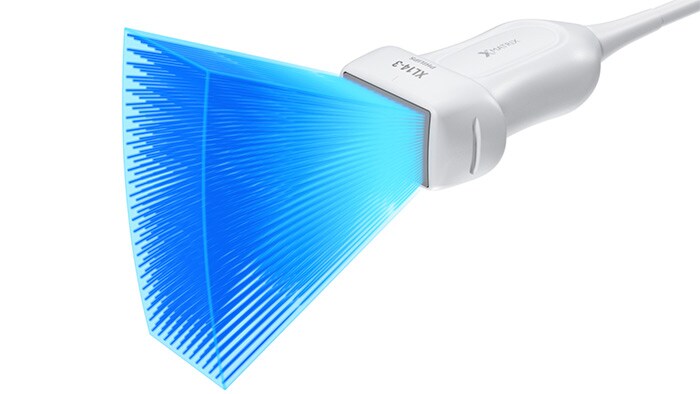 The Philips XL14-3 xMATRIX linear array transducer vascular ultrasound 3D/4D capabilities