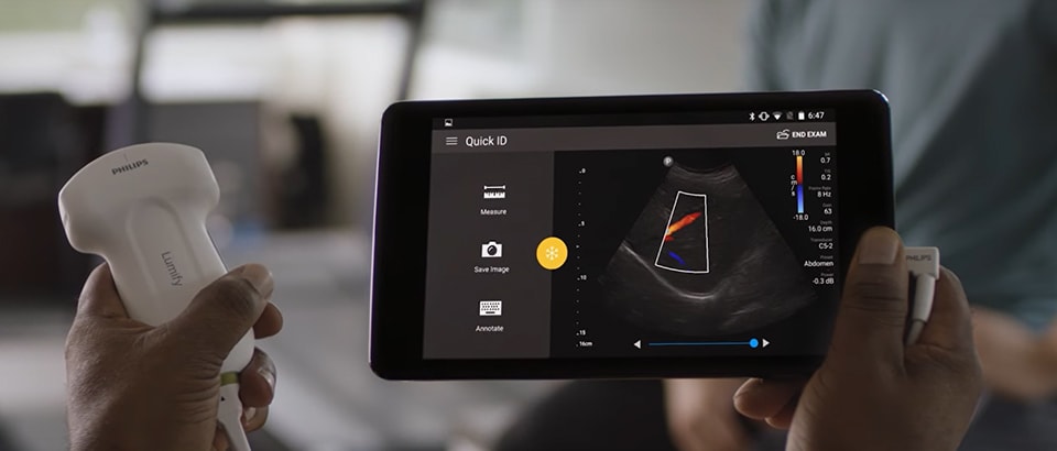 Ultrasound on your compatible smart device