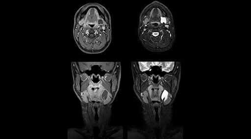 clinical case image