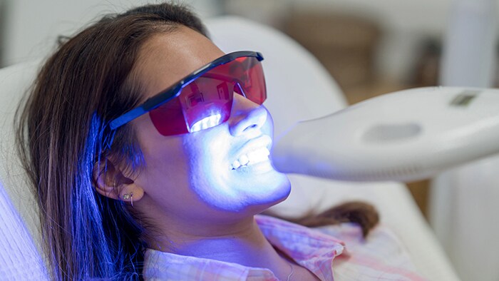 Is Teeth Whitening Safe?