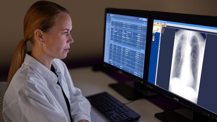 Lung cancer screening made smarter – Combining Leading Technology and AI