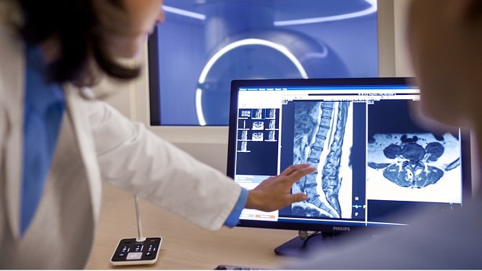 apac radiologists AI technology diagnosis challenges (opens in a new window)