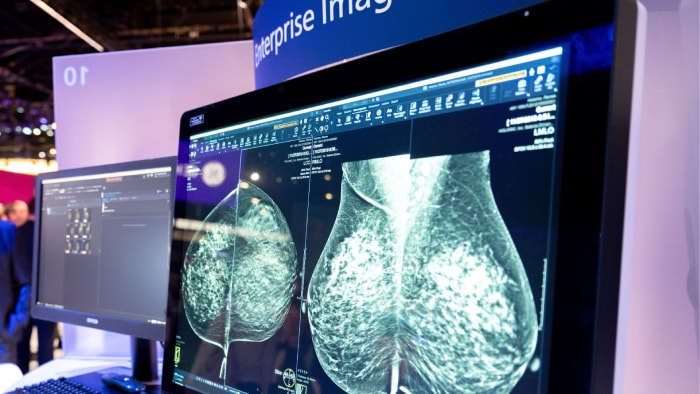 RSNA 2023 reflections: Leading through change in radiology in APAC