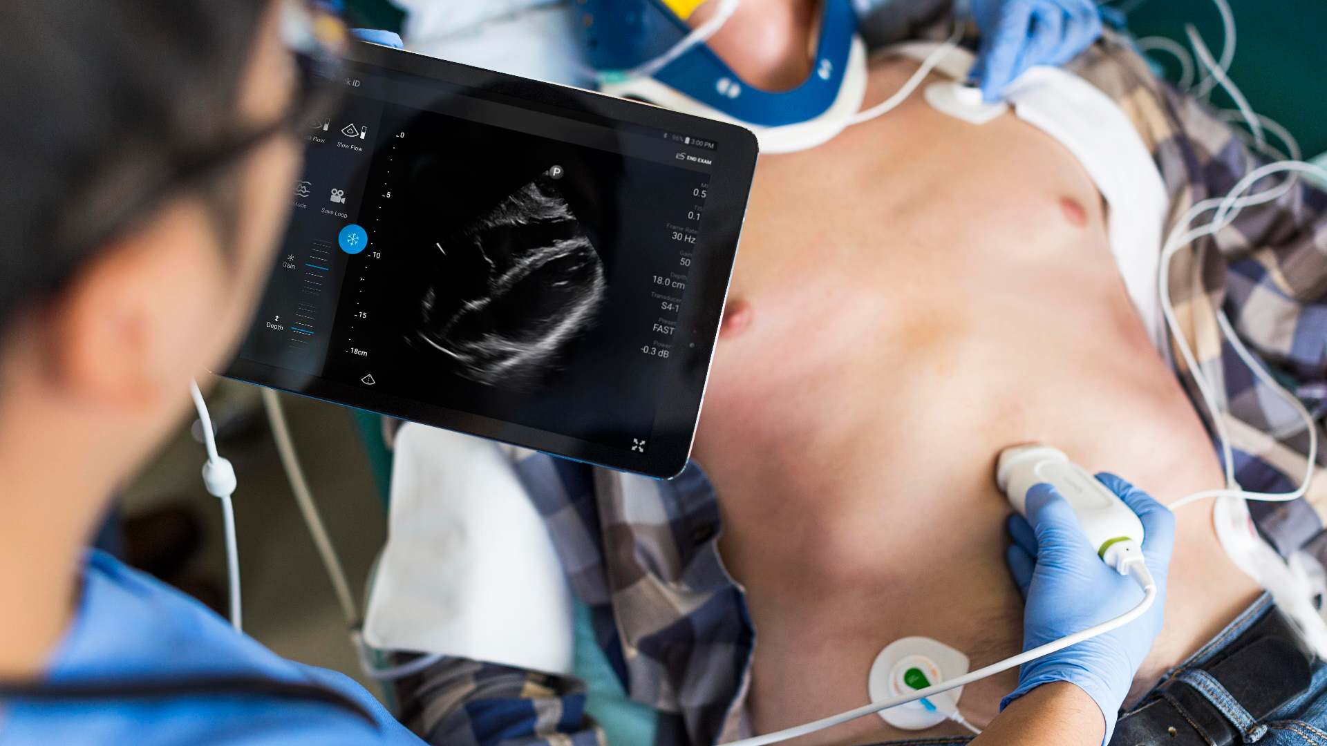 Portable, handheld Ultrasound device is ideal for remote locations or facilities with limited infrastructure