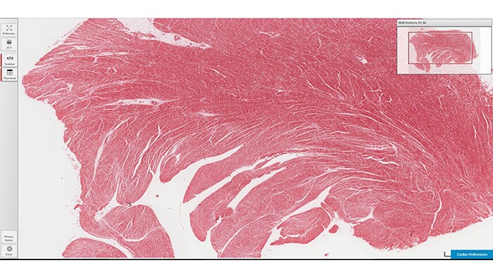 Case view